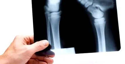 kalanddiagnosztika