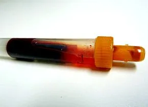 субклінічного