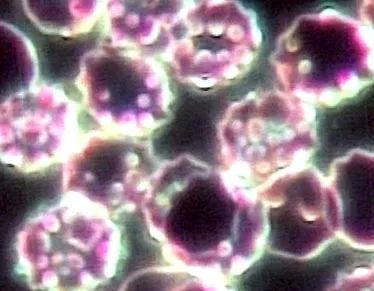 chlamydia
