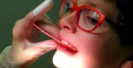 aparatele dentare