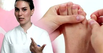 dermatologul