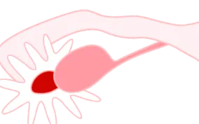 panaszok