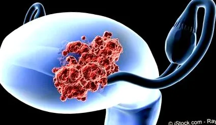 diagnostic cancer