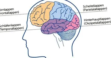 epilepsii