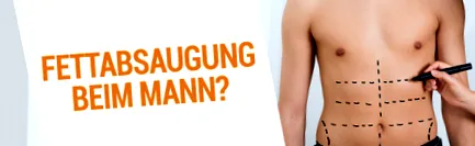 despre liposucție liposucție