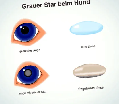 cataracta