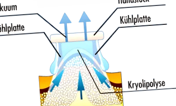 reducerea