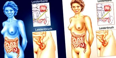 причини симптоми