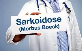 boeck