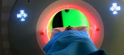 mrcp