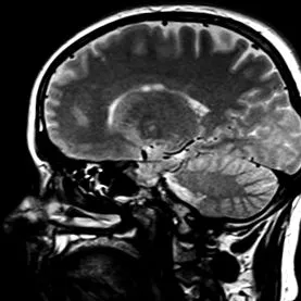 craniotomia elülső