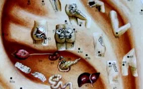 acupunctura