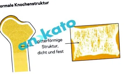 купете