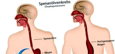 okai