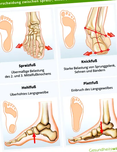 lábfenék
