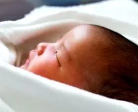 hydrocephalus
