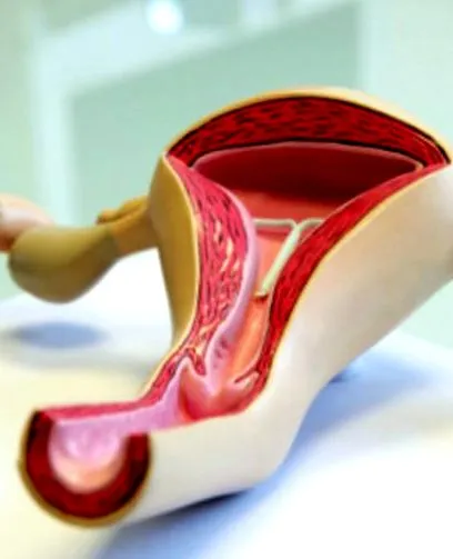 menstruáció alatt