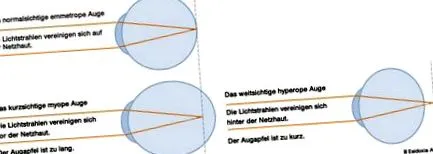 altenessen