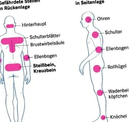 elkerülni lehet