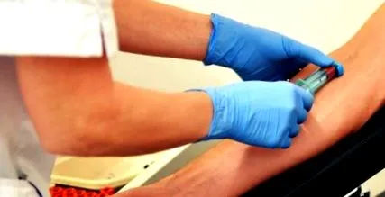 autohemoterápia