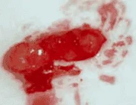 rejtett
