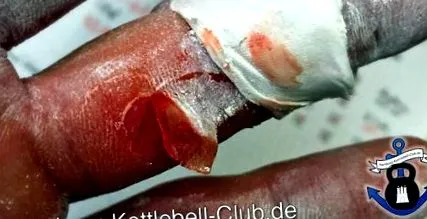 kézápolása kettlebell