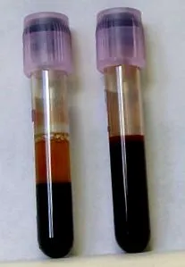 testnedv