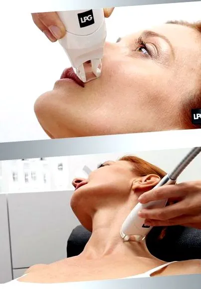 endermologie