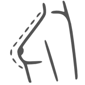 mellnagyobbítás