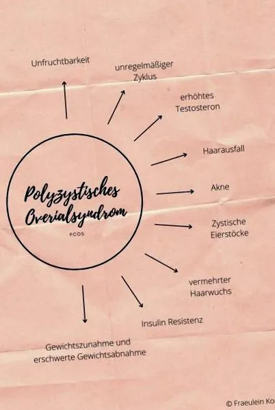 pco-szindróma