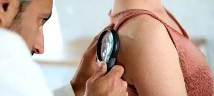lipoma