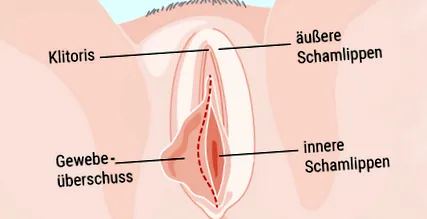 labia