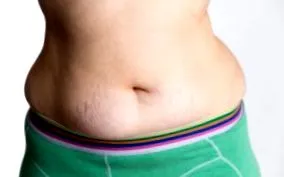 bőrfelesleg