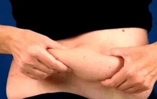 riscul
