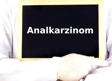 симптоми анален