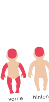 neurodermatitis