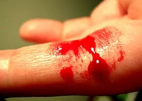 blood