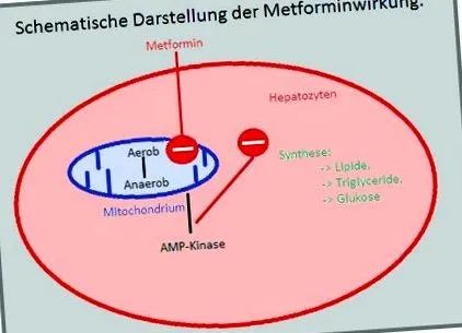 diabetes mellitus