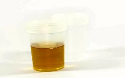 okok