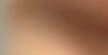 носот