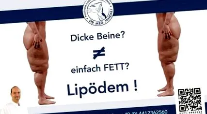 kövér