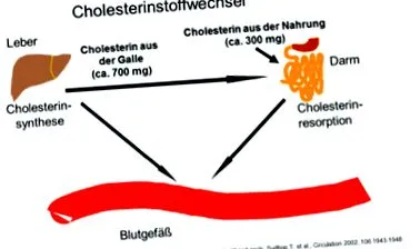 arterioscleroza