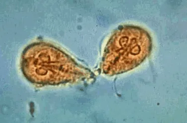 giardia