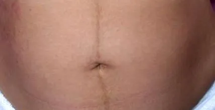 változások
