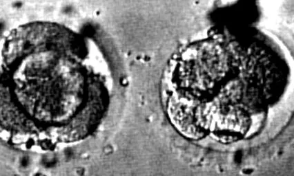 congenital malformații