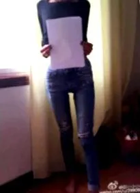 anorexia anorexia