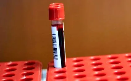 medicină nanofibre