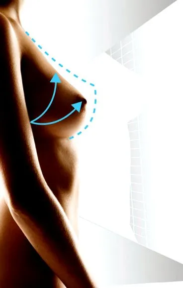 areola körül