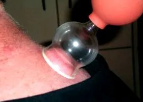 fájdalomterápia kínai