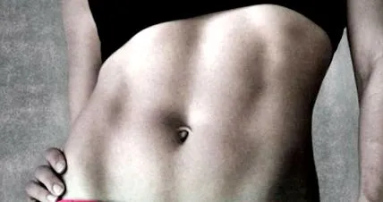 rectus